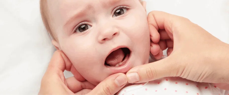 Objawy wyrzynania zębów trzonowych u dzieci - co warto wiedzieć