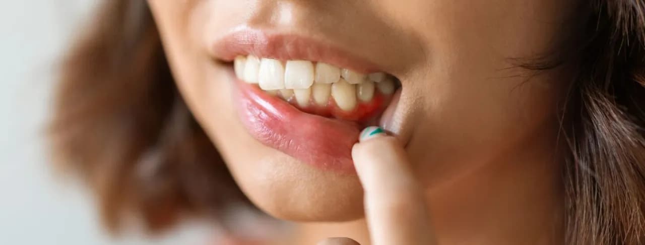 Czy antybiotyk pomoże na ból zęba? Prawda o leczeniu bólu zęba