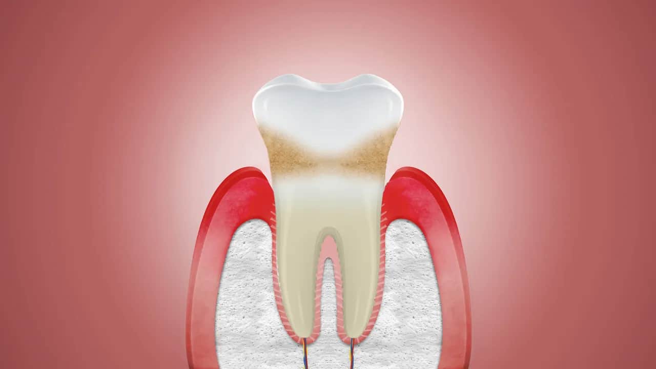 Czy dziąsła się regenerują? Poznaj ograniczenia i możliwości odbudowy