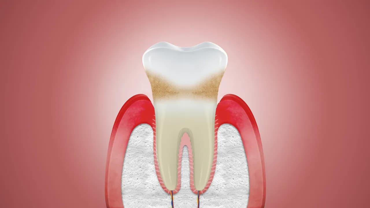 Czy dziąsła się regenerują? Poznaj ograniczenia i możliwości odbudowy