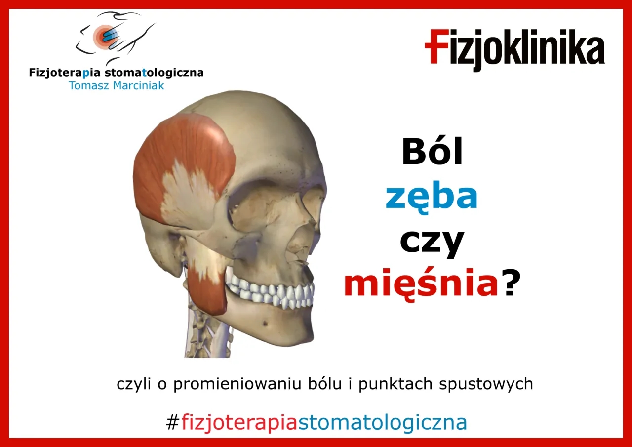 Ból głowy od zęba objawy: jak rozpoznać i uniknąć bólu