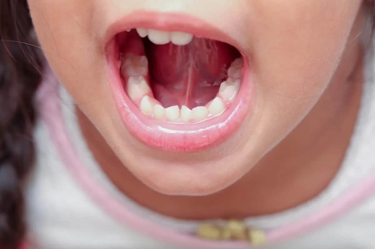 Ile zębów mlecznych ma dziecko? Odkryj ważne fakty o ich rozwoju