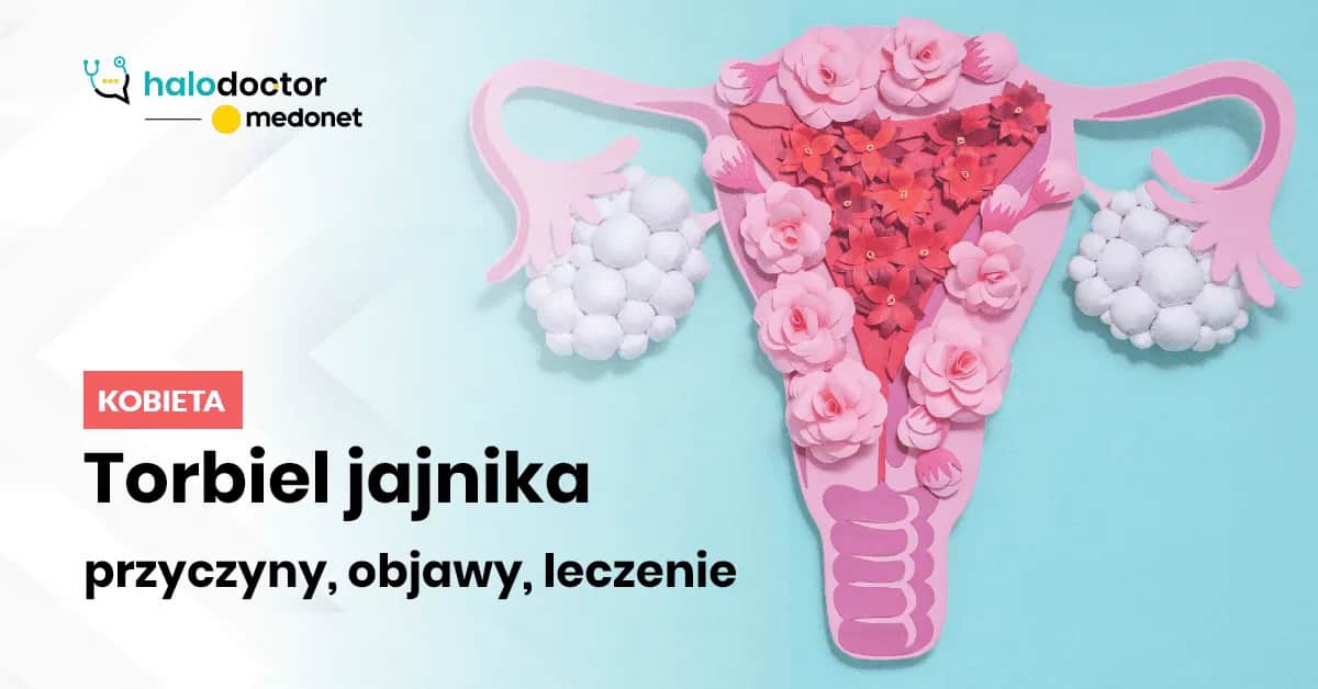 Jakie leki hormonalne na torbiel jajnika mogą skutecznie pomóc?